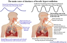 Kalp Çarpıntısı Nefes Darlığı Kalp Çarpıntısı Nefes Darlığı